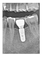 Carewell Dental Clinic Plano TX